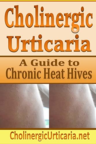 9781497387898: Cholinergic Urticaria: A Guide to Chronic Heat Hives