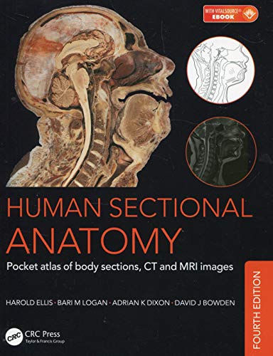 9781498708548: Human Sectional Anatomy: Pocket atlas of body sections, CT and MRI images, Fourth edition