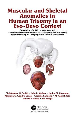 Stock image for Muscular and Skeletal Anomalies in Human Trisomy in an Evo-Devo Context for sale by Books Puddle
