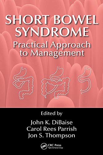 9781498720786: Short Bowel Syndrome: Practical Approach to Management