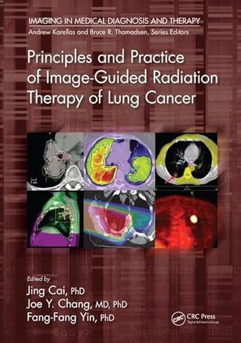 9781498736732: Principles and Practice of Image-Guided Radiation Therapy of Lung Cancer