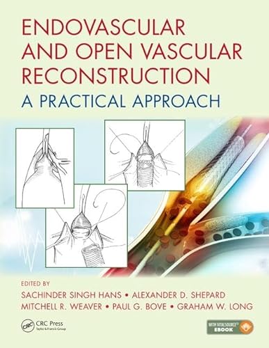 9781498760553: Endovascular and Open Vascular Reconstruction: A Practical Approach