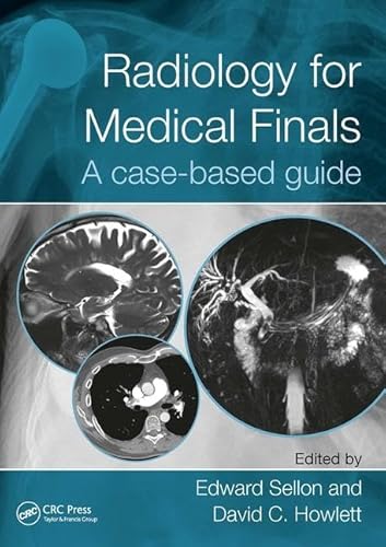 Stock image for Radiology for Medical Finals for sale by Blackwell's