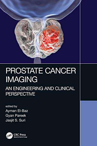 Stock image for Prostate Cancer Imaging : An Engineering and Clinical Perspective for sale by Better World Books: West