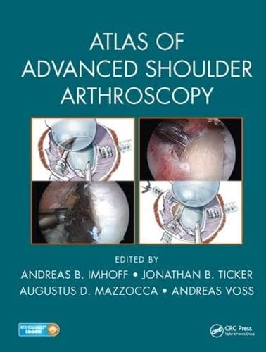 9781498787482: Atlas of Advanced Shoulder Arthroscopy