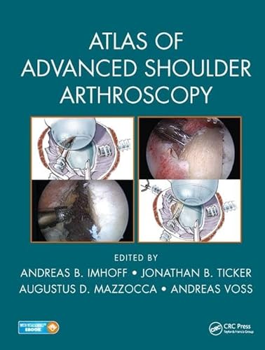 Stock image for Atals Of Advanced Shoulder Arthroscopy (Pb 2018) for sale by Basi6 International