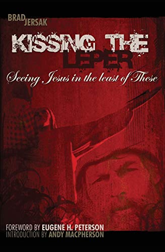 9781499341324: Kissing the Leper: Seeing Jesus in the Least of These