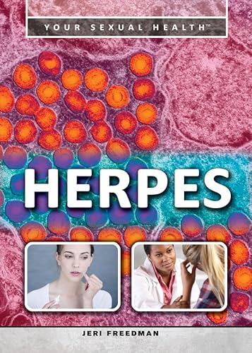9781499460544: Herpes (Your Sexual Health)