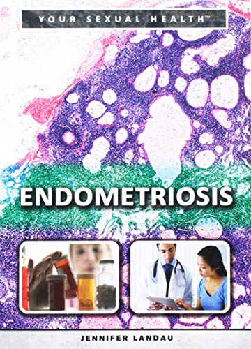 9781499460766: Endometriosis (Your Sexual Health)