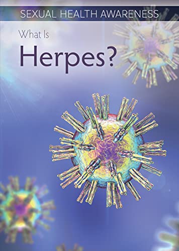 9781499472219: What Is Herpes? (Sexual Health Awareness)