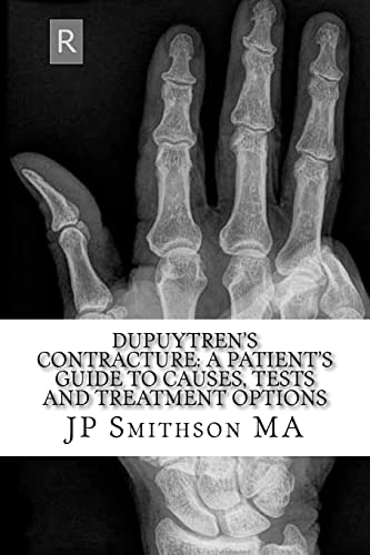 Imagen de archivo de Dupuytren's Contracture: : A Patient's Guide to Causes, Tests and Treatment Option a la venta por ThriftBooks-Dallas