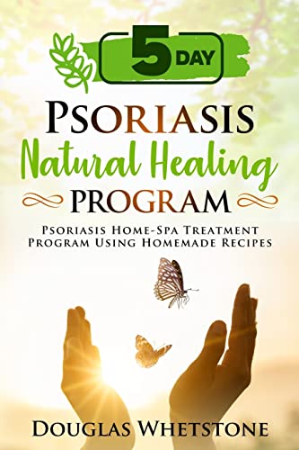 Beispielbild fr 5-Day Psoriasis Natural Healing Program: Psoriasis Home-Spa Treatment Program Using Homemade Recipes zum Verkauf von AwesomeBooks