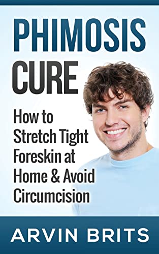 Phimosis Cure: How to Stretch Tight Foreskin at Home & Avoid Circumcision  (Penis Enhancement, Jelqing, Kegels, Erectile Dysfunction, ED) - Brits,  Arvin: 9781500995102 - AbeBooks