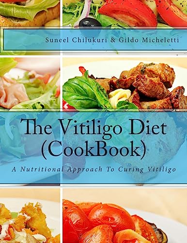 Stock image for The Vitiligo Diet (CookBook): A Nutritional Approach To Curing Vitiligo for sale by HPB-Ruby