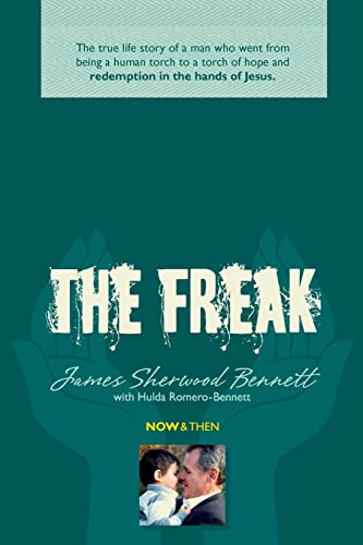 9781505448436: The Freak: The true life story of a man who went from being a human torch to a torch of hope and redemption in the hands of Jesus