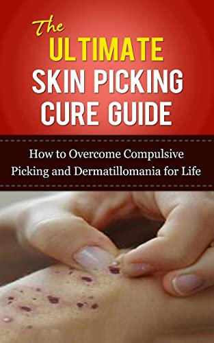 Beispielbild fr The Ultimate Skin Picking Cure Guide: How to Overcome Compulsive Picking and Dermatillomania for Life (Skin Picking Addiction, Pathological Skin . Addictions, Acne, Pimples, Rashes) zum Verkauf von Save With Sam