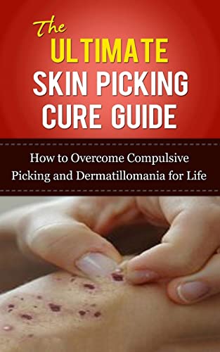 The Ultimate Skin Picking Cure Guide: How to Overcome Compulsive Picking an...