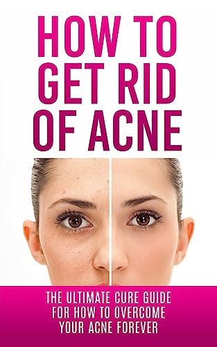 Beispielbild fr How to Get Rid of Acne: The Ultimate Cure Guide for How to Overcome Your Acne Forever zum Verkauf von THE SAINT BOOKSTORE