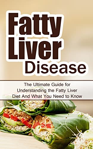 Beispielbild fr Fatty Liver Disease: The Ultimate Guide for Understanding the Fatty Liver Diet And What You Need to Know (FLD, Alcohol, NAFLD, Metabolic Syndrome, Steatosis, Alcoholic Liver Disease, Obesity) zum Verkauf von Save With Sam