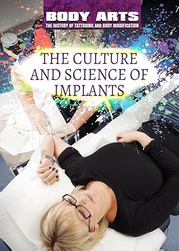 Stock image for The Culture and Science of Implants for sale by Better World Books
