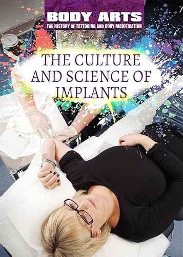 Stock image for The Culture and Science of Implants for sale by ThriftBooks-Atlanta