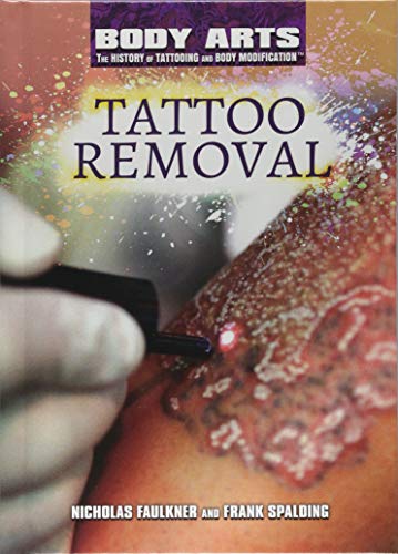 Imagen de archivo de Tattoo Removal a la venta por Better World Books