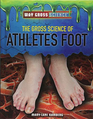 9781508181590: The Gross Science of Athlete's Foot (Way Gross Science)