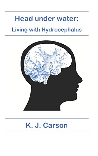 Stock image for Head under water: Living with Hydrocephalus for sale by Save With Sam