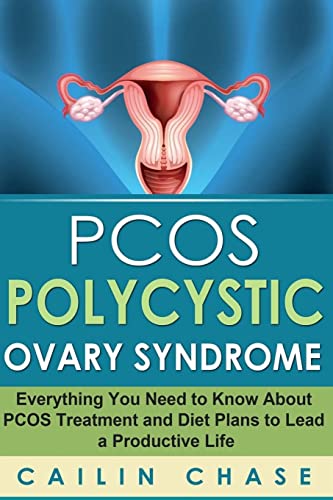 9781514216439: PCOS Polycystic Ovary Syndrome: Everything You Need to Know About PCOS Treatment and Diet Plans to Lead a Productive Life