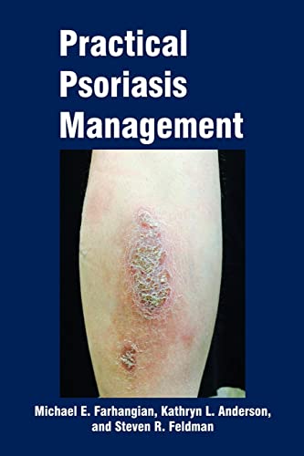 Stock image for Practical Psoriasis Management for sale by HPB-Red