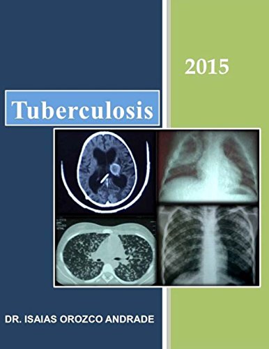 Imagen de archivo de Tuberculosis 2015 a la venta por Revaluation Books