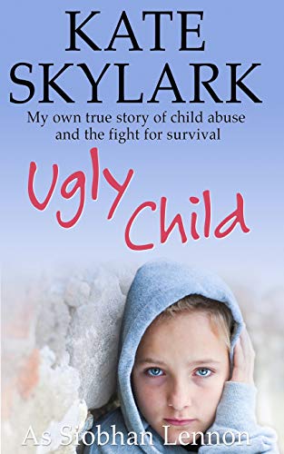 Beispielbild fr Ugly Child: My Own True Story of Child Abuse and the Fight for Survival: Volume 3 (Skylark Child Abuse True Stories) zum Verkauf von AwesomeBooks