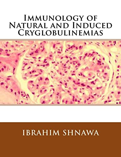 9781519523358: Immunology of Natural and Induced Cryoglobulinemia