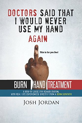 9781521317679: Burn Hand Treatment: A How-To Guide for Rehabilitation with Real Life Experiences from a Burn Survivor