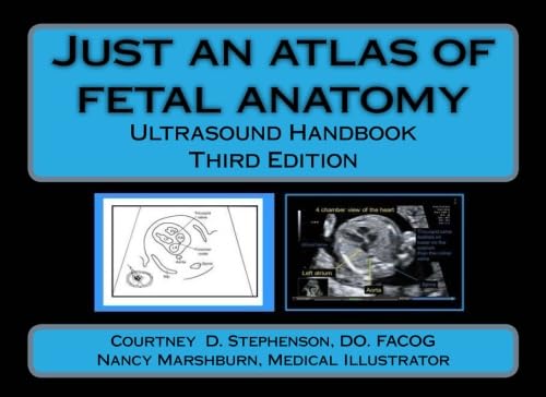 9781523632862: Just an atlas of fetal anatomy: Ultrasound Handbook