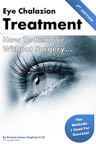 9781523853656: Eye Chalazion: How To Remove Without Surgery: My personal experience and the methods I used for success (Chalazions, Styes, Cysts: Eye treatment at home without surgery)