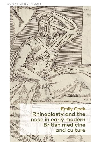 9781526160744: Rhinoplasty and the nose in early modern British medicine and culture (Social Histories of Medicine, 53)