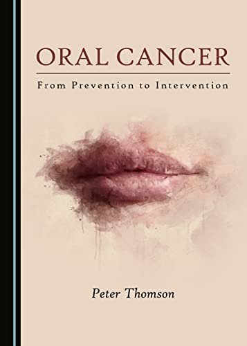 Stock image for Oral Cancer : From Prevention to Intervention for sale by AHA-BUCH GmbH