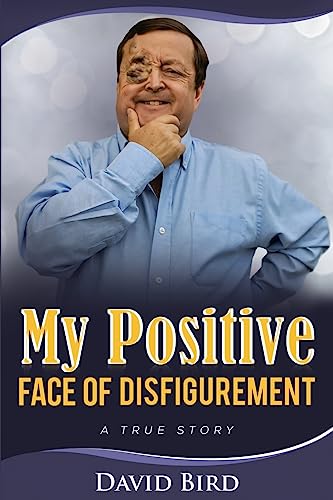 Beispielbild fr My Positive Face Of Disfigurement:: A True Story zum Verkauf von WorldofBooks