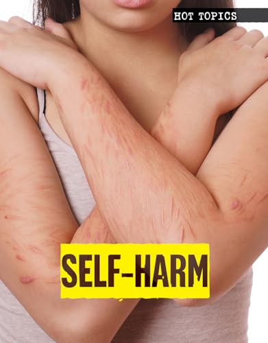 9781534560178: Self-Harm (Hot Topics)