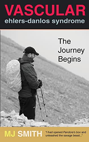 Beispielbild fr Vascular Ehlers-Danlos Syndrome: The Journey Begins zum Verkauf von WorldofBooks