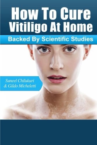 Stock image for How To Cure Vitiligo at Home: (Backed by Scientific Studies) for sale by Revaluation Books