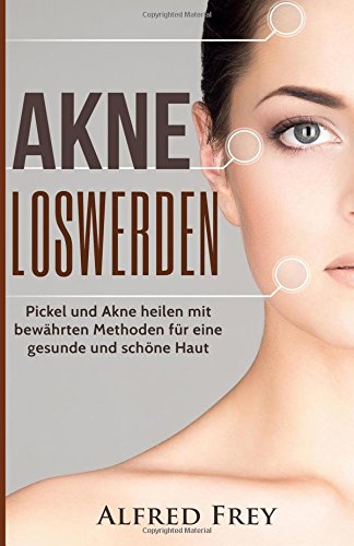 9781539099659: Akne loswerden: Pickel und Akne heilen mit bewhrten Methoden fr eine gesunde und schne Haut.