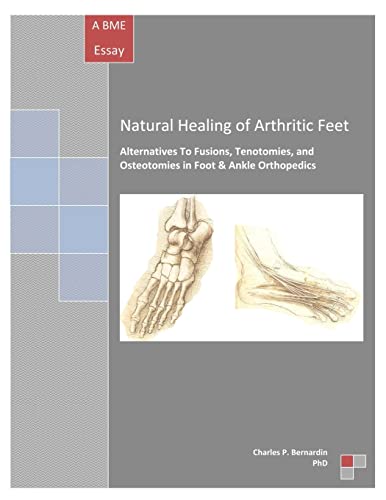 Stock image for Natural Healing of Arthritic Feet: Alternatives To Fusions, Tenotomies, and Osteotomies in Foot & Ankle Orthopedics for sale by MusicMagpie