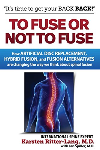 Imagen de archivo de To Fuse or Not to Fuse: How Artificial Disc Replacement, Hybrid Fusion, and Fusion Alternatives are Changing the Way We Think about Spinal Fusion a la venta por R Bookmark
