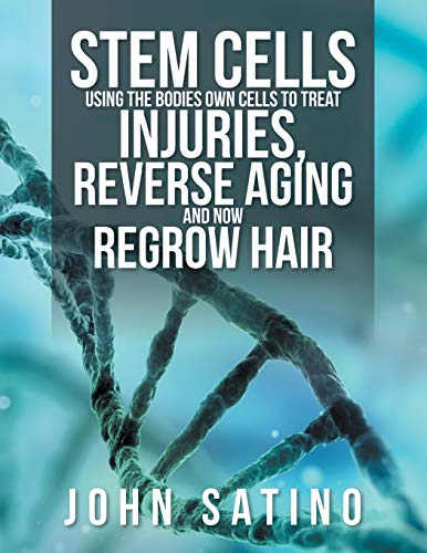 Stock image for Stem Cells Using the Bodies Own Cells to Treat Injuries, Reverse Aging and Now Regrow Hair for sale by Chiron Media
