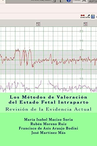 Beispielbild fr Los Mtodos de Valoracin del Estado Fetal Intraparto: Revisin de la Evidencia Actual (Volume 5) (Spanish Edition) zum Verkauf von Lucky's Textbooks