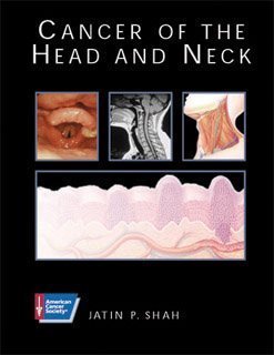 Beispielbild fr Cancer of the Head & Neck: A Volume in the American Cancer Society Atlas of Clinical Oncology Series (BC DECKER) zum Verkauf von AwesomeBooks