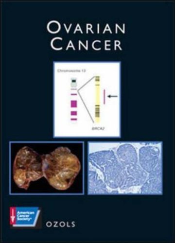 Beispielbild fr Ovarian Cancer (Atlas of Clinical Oncology) (ACS ATLAS OF CLINICAL ONCOLOGY) zum Verkauf von Bookmonger.Ltd