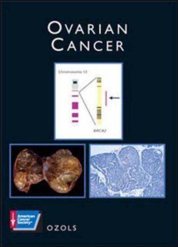Stock image for Ovarian Cancer (Atlas of Clinical Oncology) (ACS ATLAS OF CLINICAL ONCOLOGY) for sale by Bookmonger.Ltd
